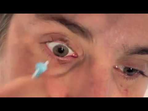 how to remove rgp contact lenses
