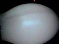 mercury lamp. lurking under borosilicate shell