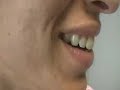 The Acne Practice  (Caucasian 3)