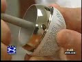 Hip Resurfacing Surgery by Robert Deveney MD