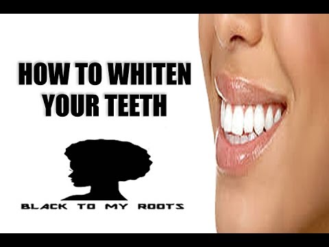 how to whiten gaps between teeth