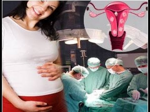 how to get rid of iud odor