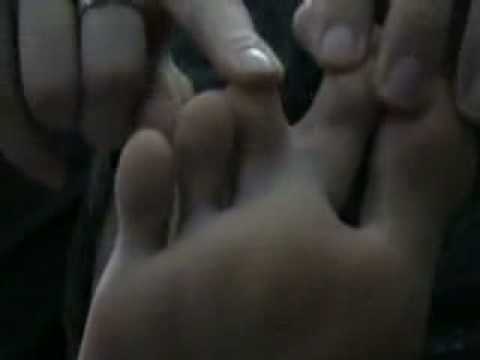 webbed toes