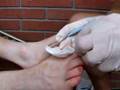 The Big Toe Blister