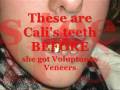 videos de VOLUPTUOUS VENEERS!