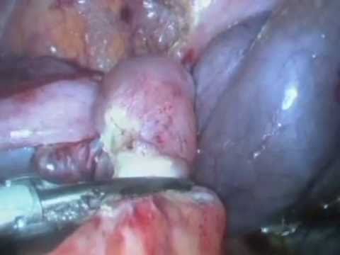 how to isolate an ip