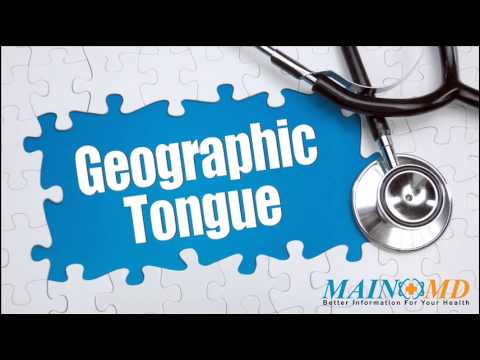 how to cure geographic tongue