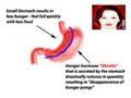 Laparoscopic Gastric Sleeve Study & Cost Costa Rica Mexico