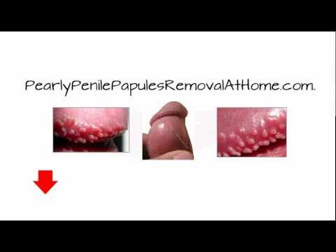 how to apply betazol g