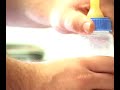 fetal-alcohol-syndrome.html