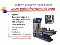 San Diego Doctor- Piriformis syndrome, Sciatica Relief, Pinched nerves, nerve Pain San Diego Doctor- Piriformis syndrome, Sciatica Relief, Pinched nerves, nerve Pain