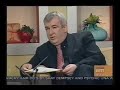 Botox and Sweating: TV3 interviews Dr. Treacy