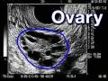 In-Vitro Fertilization (IVF) 101 (Pregnancy Health Guru)