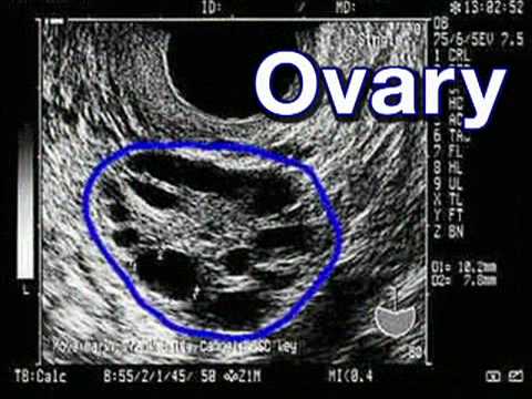 how to fertilize pregnancy