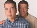 Epilepsy: Personal Stories