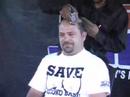 a-hair-loss-drug-may-help-detect-aggressive-prostate-tumors.html