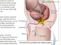 Prostate Milking the Male G-Spot