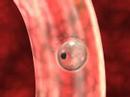 Medical animation of egg fertilization