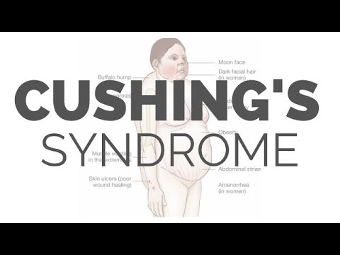 how to treat cushing's disease