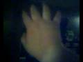 Broken Hand