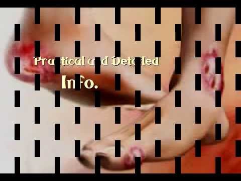 how to treat ketones