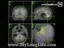 Detect Illness Earlier