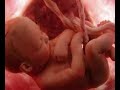 El Aborto