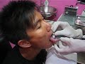 Tongue Piercing