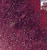 Shotgun Histology Elastic Cartilage