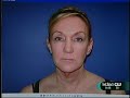 Face Lift, Wide Awake live on KTLA (part 2)