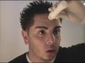 Electro Collagen Induction Therapy