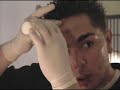 Thumbnail #3