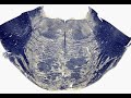 Doctor Brain Pontine Trigeminal Nuclei