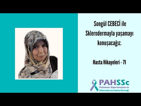 Hasta Hikayeleri - Songül CEBECİ ile Sklerodermayla Yaşamak - 71 - 2022.12.06