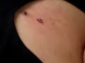 Fourth Dermal Movie Fourth Dermal Movie