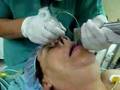 medico anestesiologo  intubacion nasal