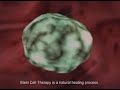 Stem Cell Injection Heart Disease Balloon Failure