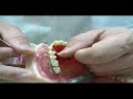 Higiene dental parte 4