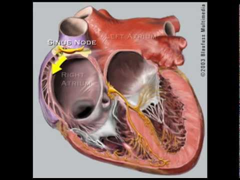 how to treat svt in pregnancy