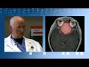 Treating Brain Tumors with New Minimally Invasive CO2 Laser Fibers: Dr. Tew, Mayfield Clinic
