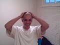 patrick's reactions within moments of being shaved completely bald.