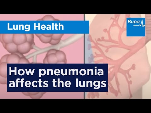 how to control lungs infection