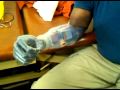 TRYING OUT THE I LIMB