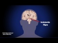 Progress and Promise in Parkinson's Disease