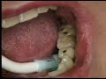 Watch Video