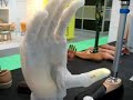 Mano bionica I-Limb - bionic hand Mano bionica I-Limb - bionic hand
