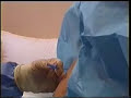 dural tap