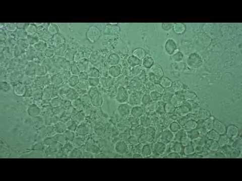 how to relieve urethritis