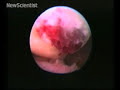 Human ovulation captured on film Human ovulation captured on film