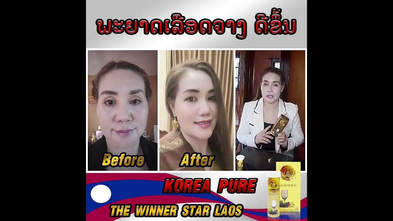 Korea Pure Review By ລານ ບຸນມີໄຊ